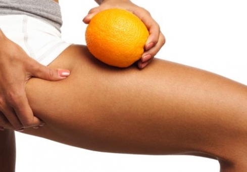 Cellulite - Are the foods you eat causing fat cells ?